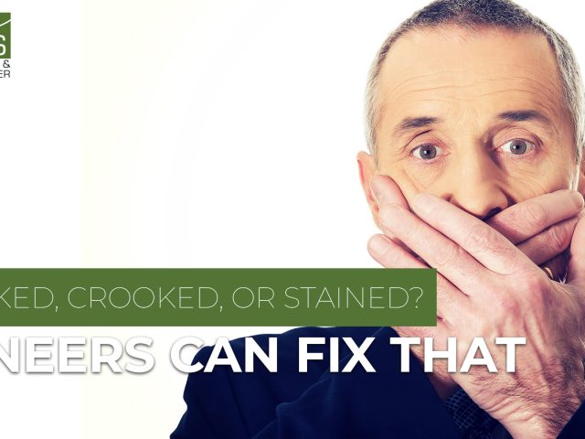 Cracked, Crooked, or Stained? Veneers Can Fix That (featured image)