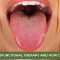 What Is Myofunctional Therapy and How Can It Help? (featured image)